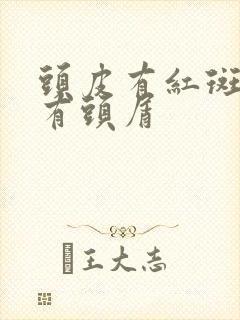 头皮有红斑发痒有头屑