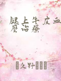 腿上牛皮血癣怎么治疗