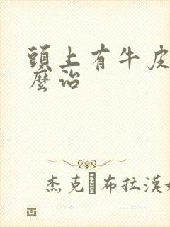 头上有牛皮选怎么治