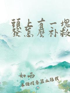 头上有一块没头发怎么补救