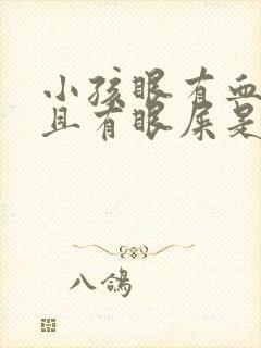 小孩眼有血丝并且有眼屎是怎么回事?