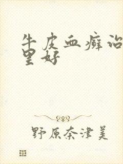 牛皮血癣治疗那里好