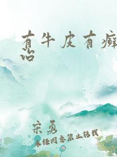 有牛皮有癣如何治