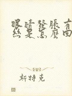 眼睛发胀有红血丝是怎么回事