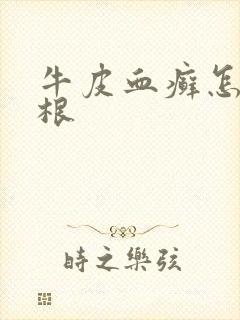 牛皮血癣怎么除根