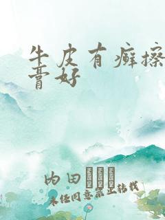 牛皮有癣擦啥药膏好