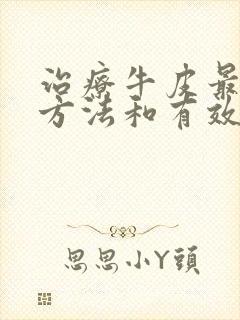 治疗牛皮最好的方法和有效的药