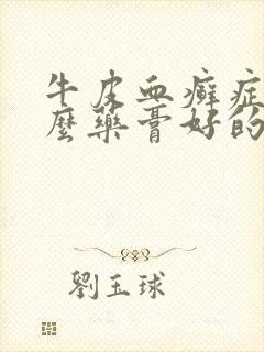 牛皮血癣症用什么药膏好的快