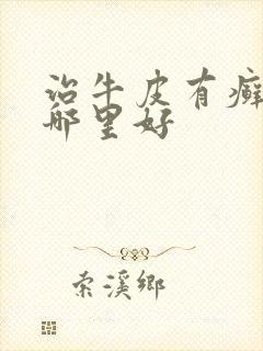 治牛皮有癣治疗哪里好