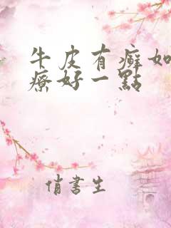 牛皮有癣如何治疗好一点