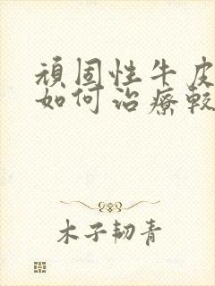 顽固性牛皮血癣如何治疗较好