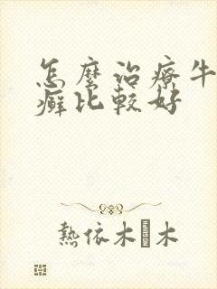 怎么治疗牛皮有癣比较好