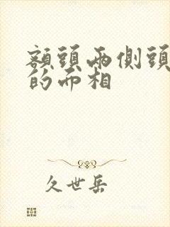 额头两侧头发秃的面相