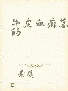 牛皮血癣怎么得的