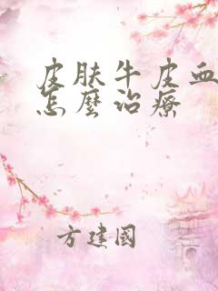 皮肤牛皮血癣该怎么治疗