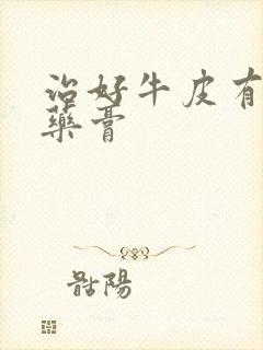 治好牛皮有癣的药膏