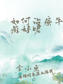 如何治疗牛皮有癣好呢