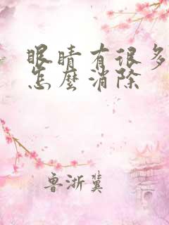 眼睛有很多血丝怎么消除