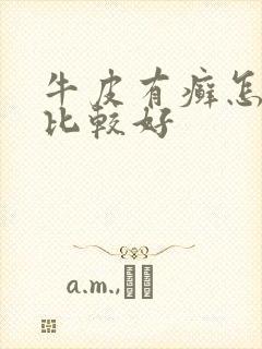 牛皮有癣怎么治比较好