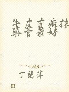 牛皮有癣抹什么药膏最好