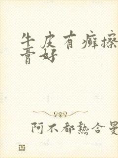 牛皮有癣擦啥药膏好