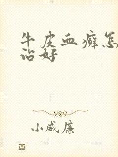 牛皮血癣怎么能治好