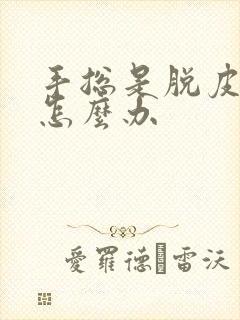 手总是脱皮开裂怎么办