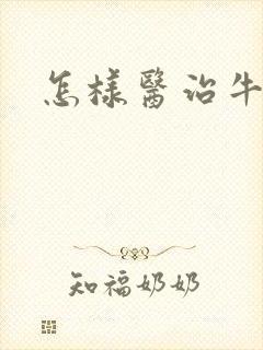 怎样医治牛皮选