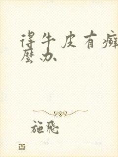 得牛皮有癣了怎么办