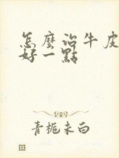 怎么治牛皮有癣好一点