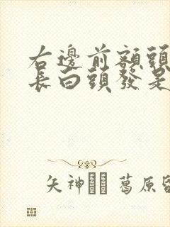 右边前额头上面长白头发是什么原因