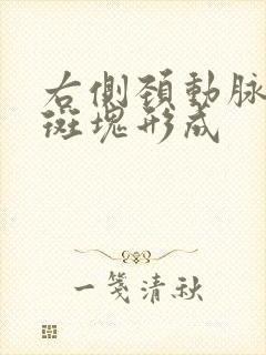 右侧颈动脉局部斑块形成