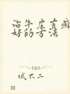 治牛皮有癣比较好的方法