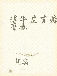 得牛皮有癣了怎么办