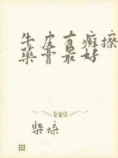 牛皮有癣擦什么药膏最好