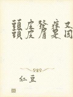 头皮发痒又没有头皮屑是因为什么