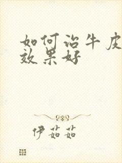 如何治牛皮有癣效果好