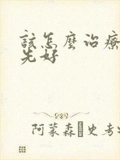 该怎么治疗牛皮先好