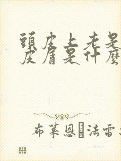 头皮上老是有头皮屑是什么原因