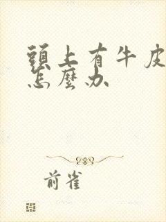 头上有牛皮血癣怎么办