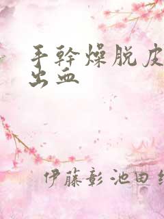 手干燥脱皮开裂出血