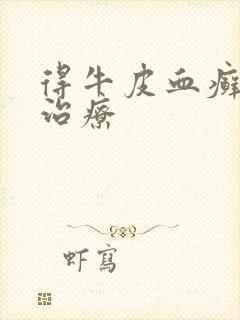 得牛皮血癣怎么治疗