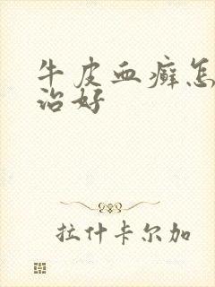 牛皮血癣怎样能治好