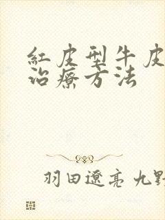 红皮型牛皮选的治疗方法