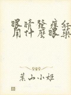 眼睛发痒红血丝用什么眼药水