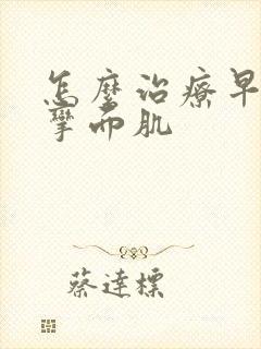 怎么治疗早期痉挛面肌