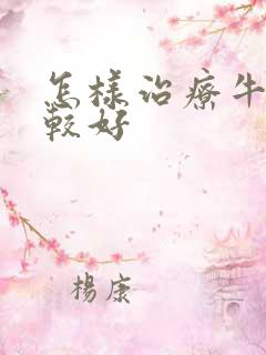 怎样治疗牛皮比较好