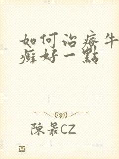 如何治疗牛皮有癣好一点