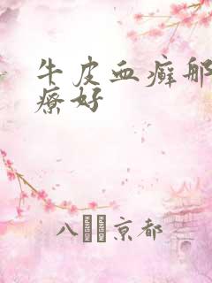 牛皮血癣那里治疗好