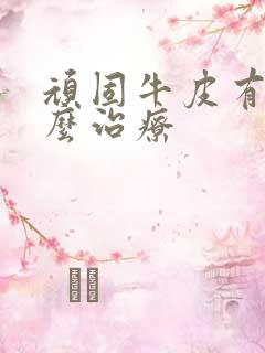 顽固牛皮有癣怎么治疗